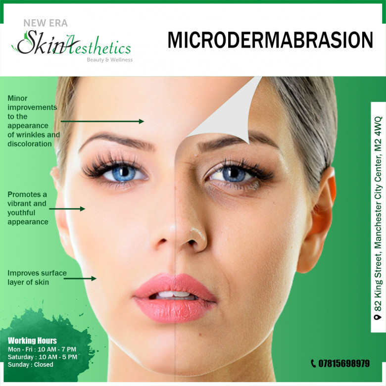 Microdermabrasion Manchester